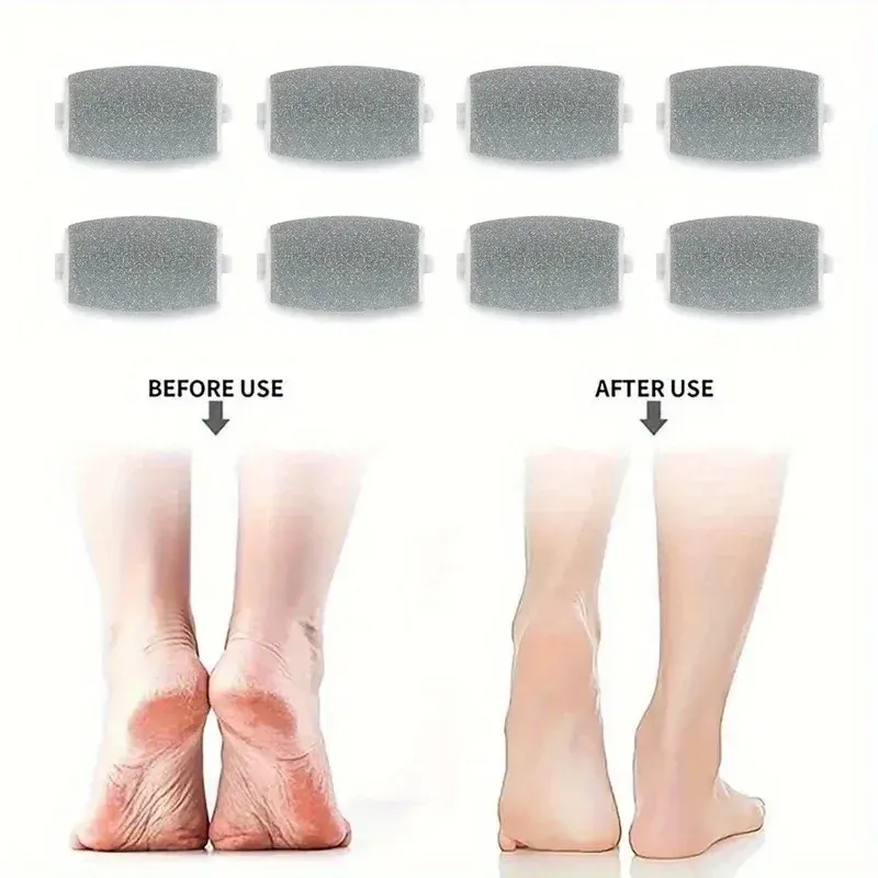 Vue détaillée de la tête d'exfoliation