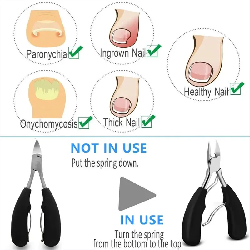 Coupe-ongles pour orteils professionnel en acier inoxydable, lame incurvée et tranchante, pour pédicure et soins du paronychium, grandes pinces 2
