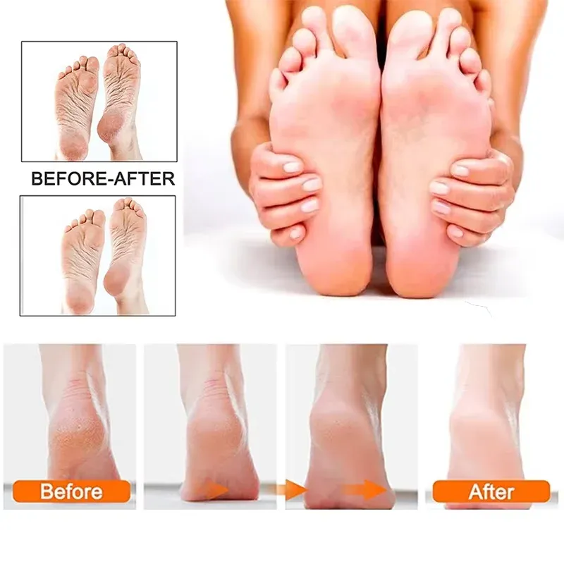 Lime électrique pour pieds, accessoires inclus