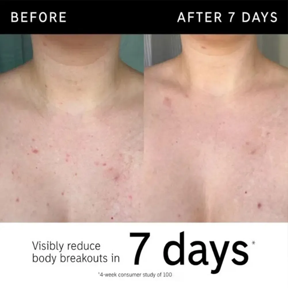 The Inkey List Exfoliating Body Stick – Gel nettoyant exfoliant à l'acide glycolique pour peaux ternes, lissantes et anti-rides 6