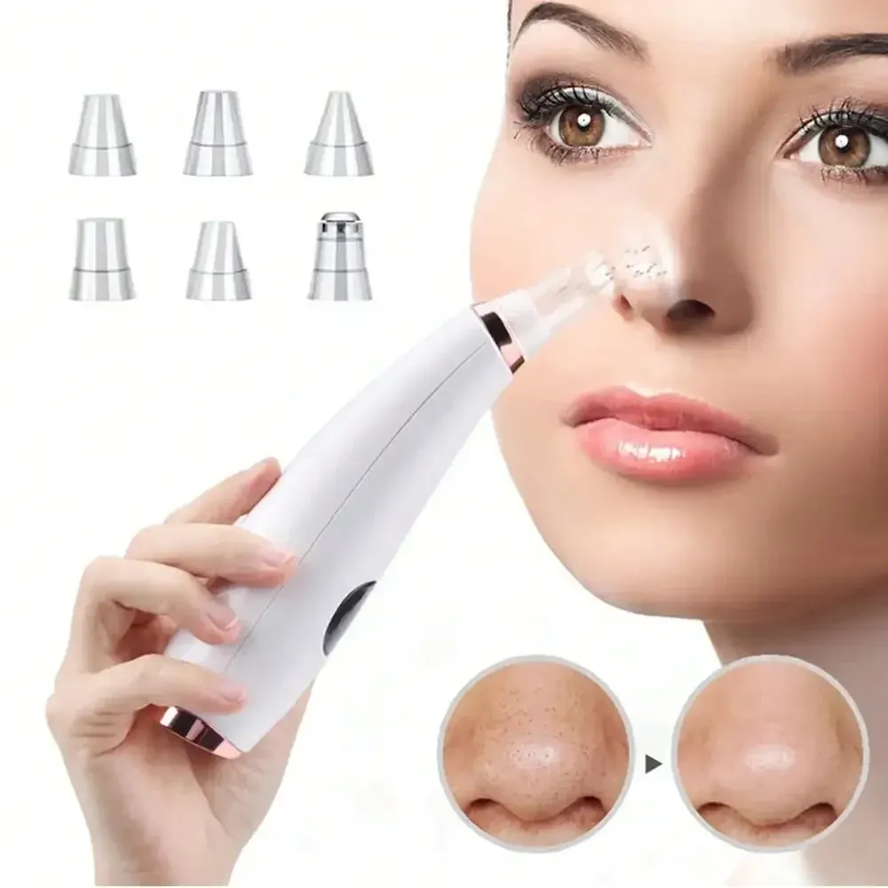Aspirateur électrique pour points noirs, nettoyeur d'acné, élimination des taches noires, nettoyage en profondeur du visage, Machine de nettoyage des pores, outils de soins de la peau 5