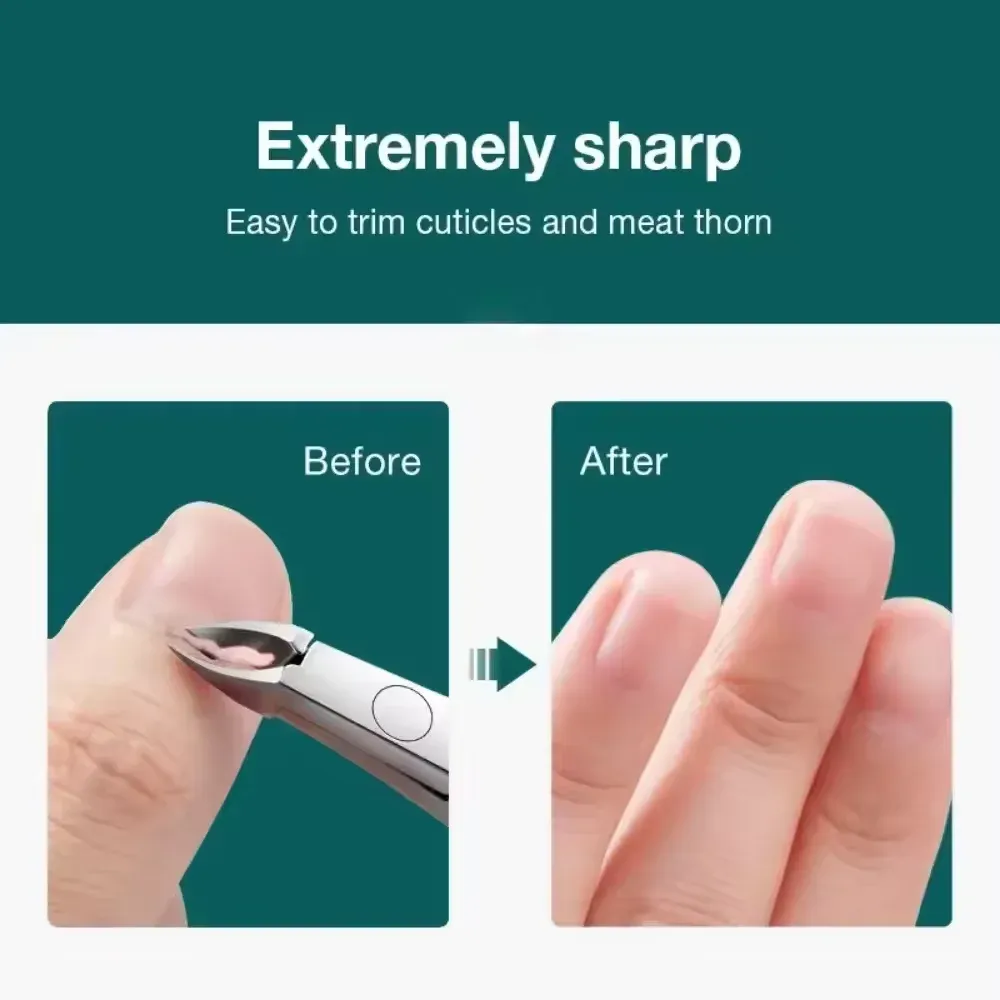 Pince à cuticules et ongles incarnés, coupe-ongles et ciseaux de pédicure 2