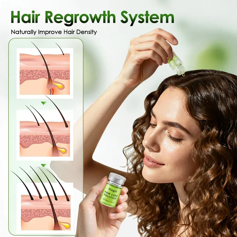 Sérum capillaire essentiel renforçant pour les racines, anti-chute, nourrissant pour le cuir chevelu 3