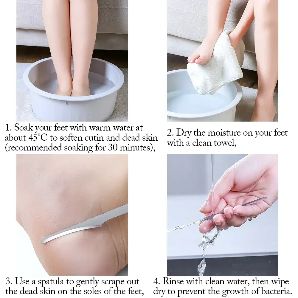 Grattoir exfoliant en acier inoxydable pour pieds, outil de soin des pieds, lot de 1 à 10 pièces 6