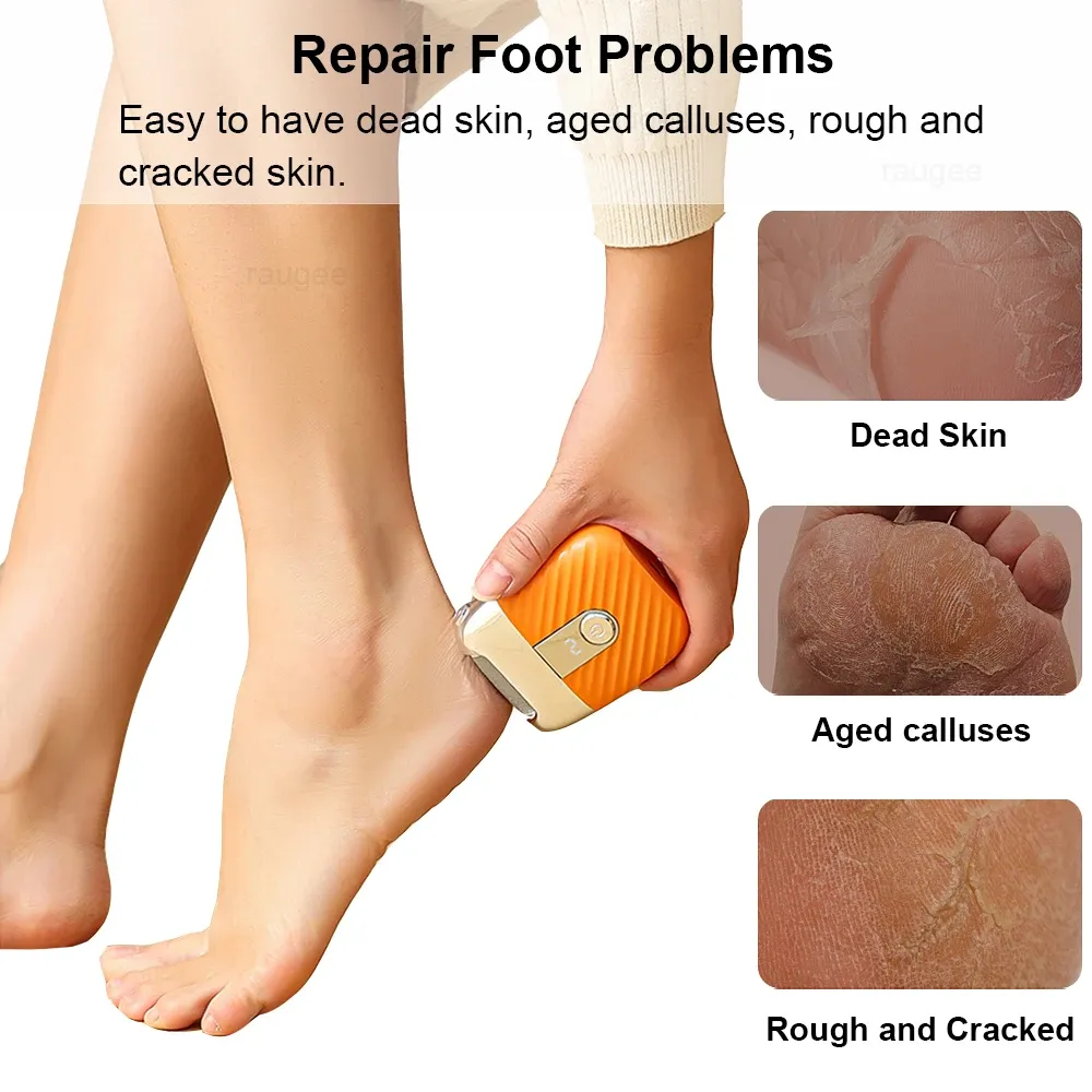 Ponceuse électrique pour pieds rechargeable et portable, éliminateur automatique de callosités et de peaux mortes sèches et craquelées 2