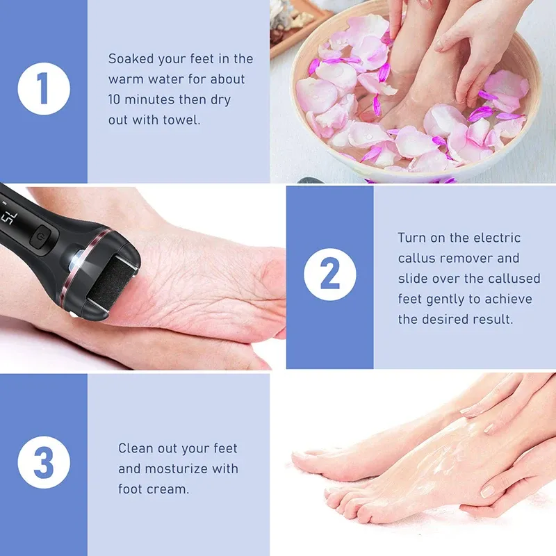 Râpe électrique pour les pieds, anti-callosités 4