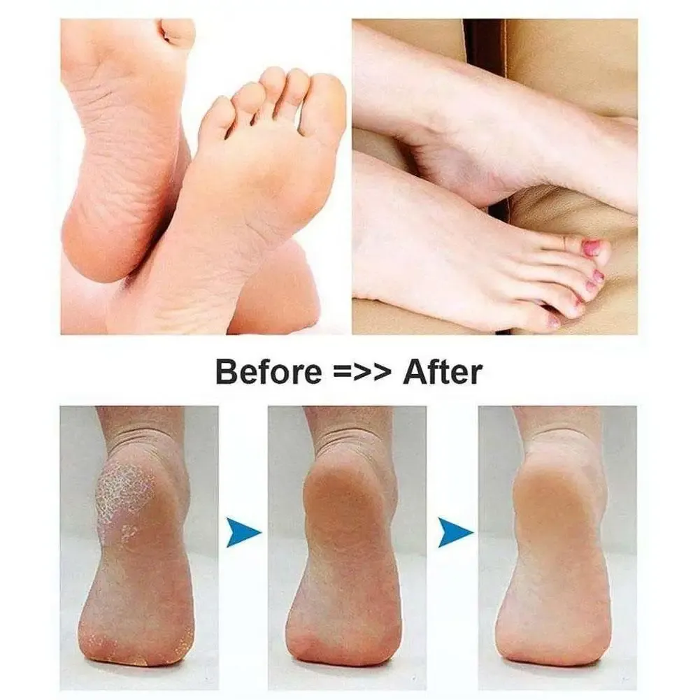 Soin des pieds avec la rectifieuse électrique